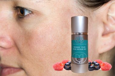Biomax Oil helps to improve acne, scars, stretch marks, pigmentation, sun damage, uneven skintone, dryness and much much more...